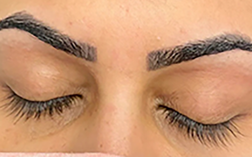 Eyes